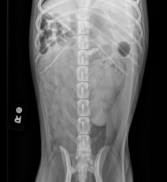 Nursing case study: abdominal pain picture