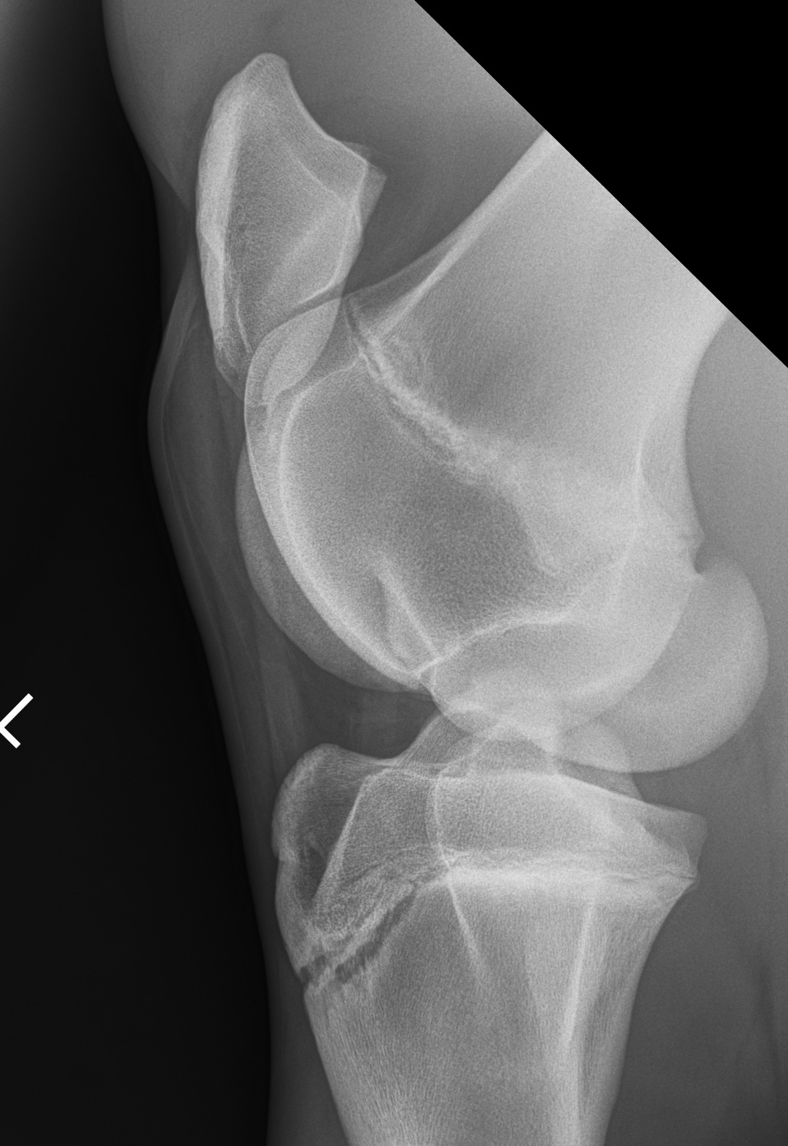 It's Your Case 2 yo M Standardbred Horse, with a bilateral stifle