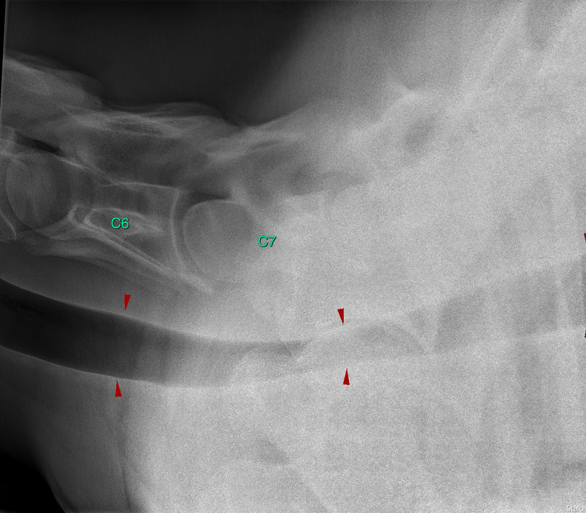 Cervical Spine Caudal annotated
