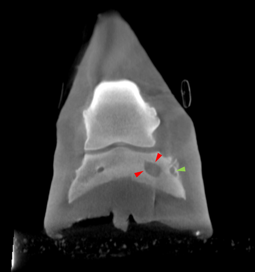 Frontal Anotated