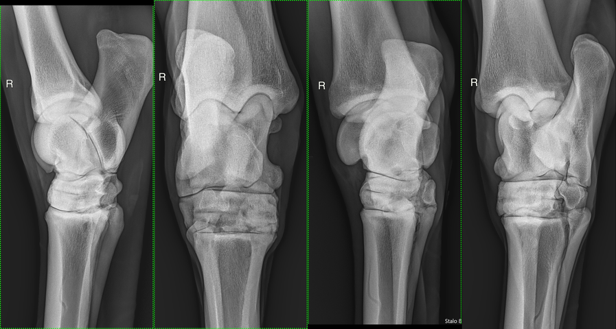fundamentals distal tarsal joint