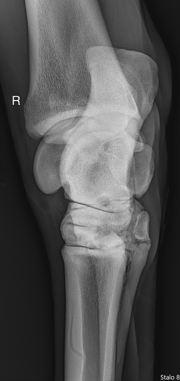 Right Tarsus DMPLO